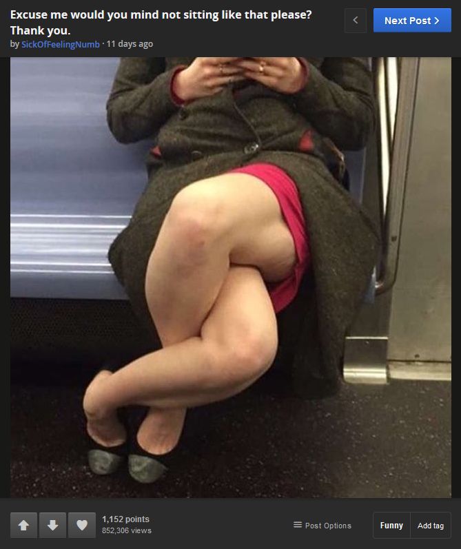 Foto: Imgur - Bizarna fotka o kojoj pričaju milioni: Šta se to događa s nogama ove žene?