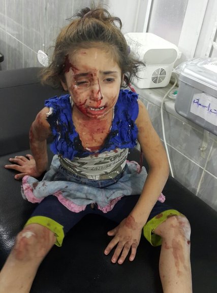 sirija_djeca_ranjena_rat_blog1.jpg - Jedna fotografija sirijskog dječaka privukla je pažnju svijeta: Ovih sedam nije zamijećeno