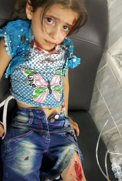 sirija_djeca_ranjena_rat_blog7.jpg - Jedna fotografija sirijskog dječaka privukla je pažnju svijeta: Ovih sedam nije zamijećeno