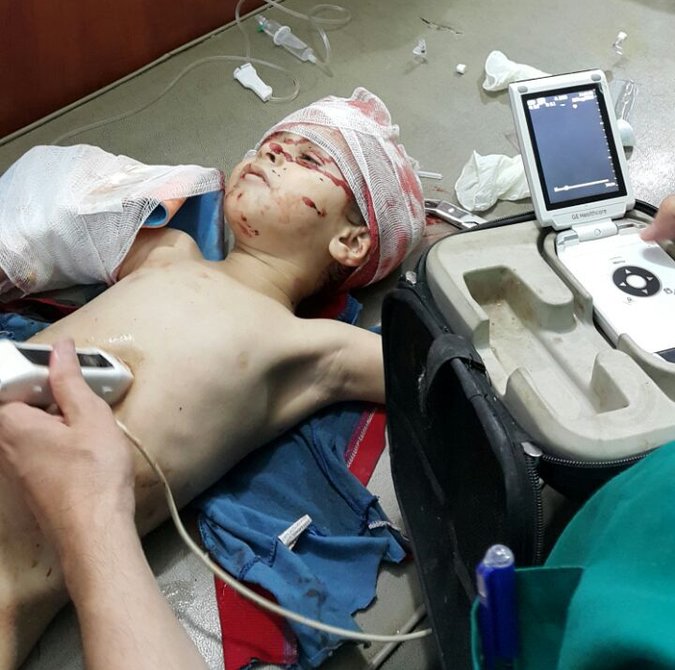 sirija_djeca_ranjena_rat_blog4.jpg - Jedna fotografija sirijskog dječaka privukla je pažnju svijeta: Ovih sedam nije zamijećeno