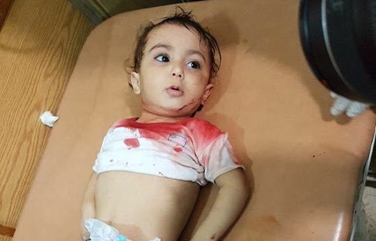 sirija_djeca_ranjena_rat_blog3.jpg - Jedna fotografija sirijskog dječaka privukla je pažnju svijeta: Ovih sedam nije zamijećeno