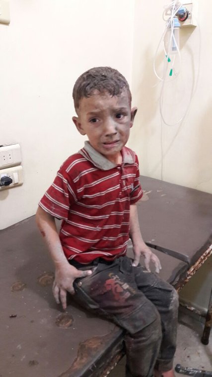 sirija_djeca_ranjena_rat_blog6.jpg - Jedna fotografija sirijskog dječaka privukla je pažnju svijeta: Ovih sedam nije zamijećeno