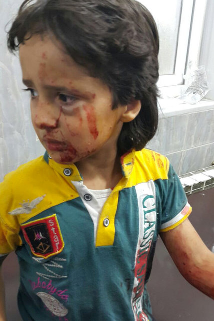 sirija_djeca_ranjena_rat_blog8.jpg - Jedna fotografija sirijskog dječaka privukla je pažnju svijeta: Ovih sedam nije zamijećeno