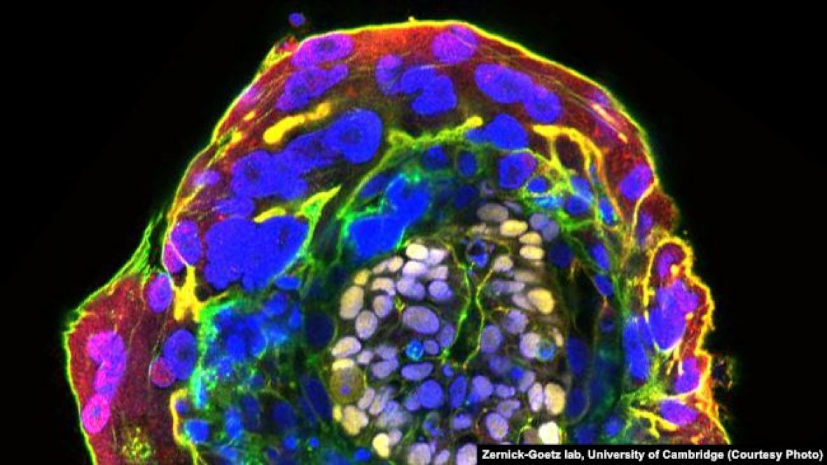 Ljudski embrion, star 11 dana  - undefined