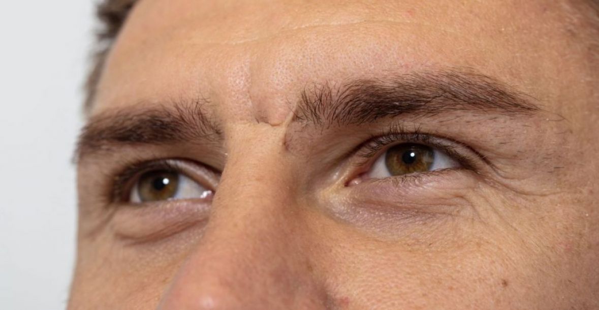 Ermin Bičakčić otkrio detalje o ožiljku na licu - undefined