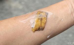 Uzmite komad bananine kore i zalijepite za kožu