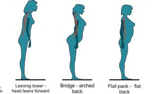 Vaše držanje otkriva da li ćete razviti hroničnu bol u leđima