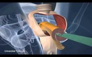 Sve otkriveno: Kako muškarac postaje žena