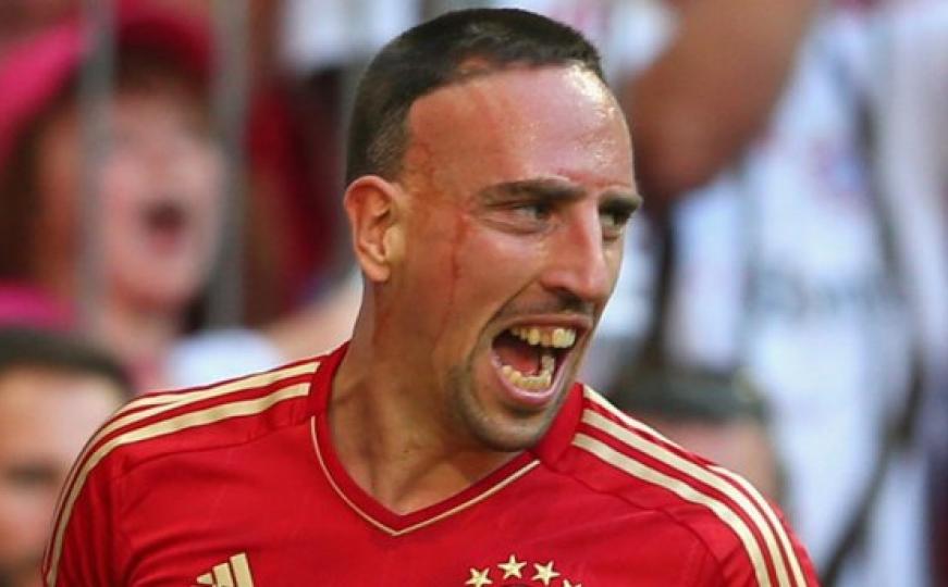 Tek što se vratio na teren: Franck Ribery se u Zagrebu ponovno povrijedio