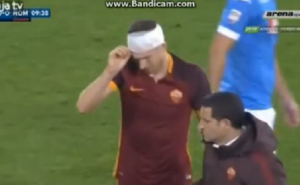 Igrač Napolija 'razbio' glavu Edinu Džeki (VIDEO)