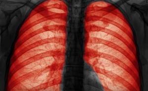 Kako zagađen zrak utječe na organizam (VIDEO)