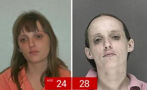 Lice ovisnosti: Ovako izgledaju osobe prije i poslije uzimanja metha (FOTO)