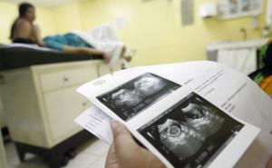 Otkriven uzrok raka jajnika: Za sve je kriva anomalija na genu BRIP1