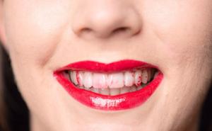 FOTO: Kad se uljepšavanje pretvori u 'horor'