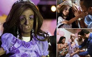 Djevojčica koja ubrzano stari proslavila 15. rođendan