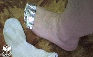 Zašto je dobro omotati prste aluminijskom folijom