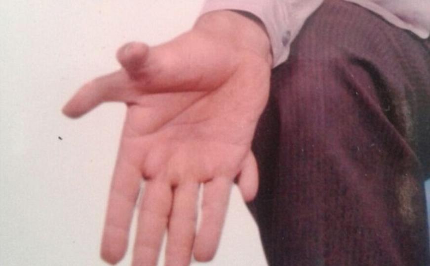 Za Guinnessa: Stolar iz Indije ima 28 prstiju, stalno brine da jedan ne odreže (FOTO)