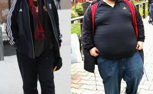 FOTO: Podvrgnuo se hirurškom zahvatu i za deset mjeseci izgubio 109 kilograma 