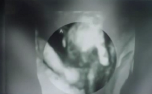 Ljekari su roditeljima kazali da njihova beba ne može preživjeti, a onda su pogledali ultrazvuk...