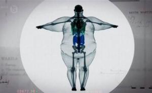 Istraživanje: Pretili ljudi pamte slabije od svojih mršavijih prijatelja