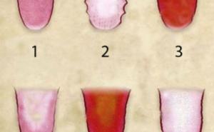 Deset promjena na jeziku otkriva kakvog ste zdravlja