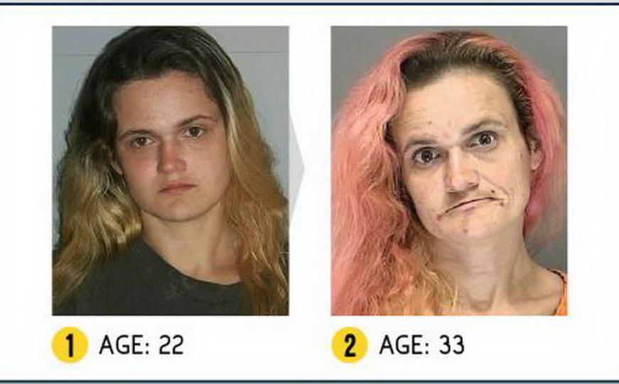 Lice ovisnosti: Šta godine korištenja heroina, kokaina i oksikodona čine tijelu?