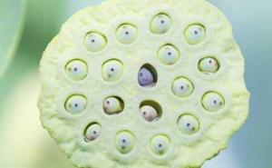 Da li vam smeta ova fotografija: Možda imate blaži poremećaj