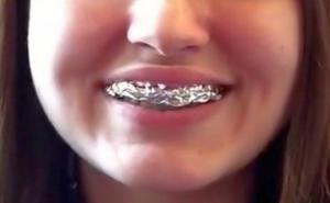 Evo šta se desi kad na zube stavite ALU foliju