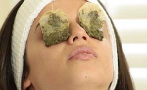 Imate probleme s podočnjacima? Jednostavni načini kako da ih se riješite (VIDEO)