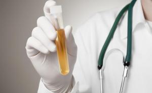 Prirodni antibiotik koji liječi svaku upalu mjehura