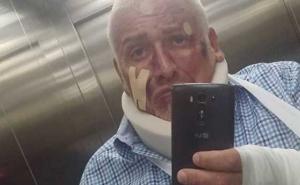 Dragan Marinković Maca postavio fotografiju na kojoj je 'pretučen'