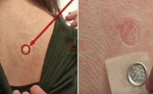 Šta se desi kada stavite bateriju na leđa?