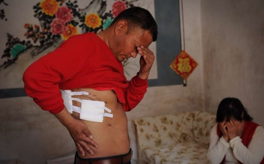 Kinez izgubio bubreg, doktori tvrde da je "nestao sam od sebe"