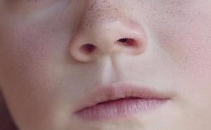 Otkrivena četiri gena koja utiču na oblik i širinu ljudskog nosa