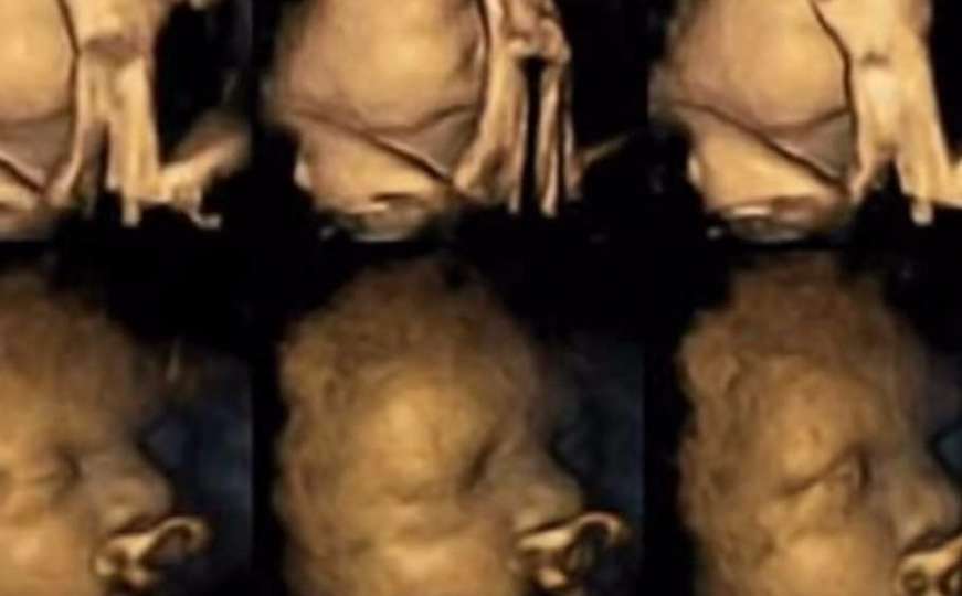 Snimke ultrazvuka pokazuju kako pušenje utječe na bebe