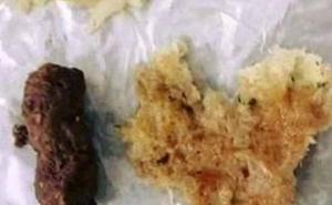 Ljubav na bosanski način