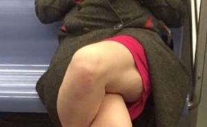 Bizarna fotka o kojoj pričaju milioni: Šta se to događa s nogama ove žene?