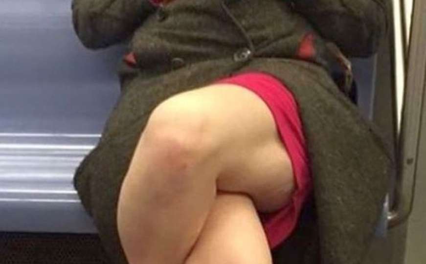Bizarna fotka o kojoj pričaju milioni: Šta se to događa s nogama ove žene?