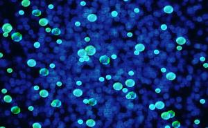 Osim virusa Zika, Riju prijeti i super bakterija?