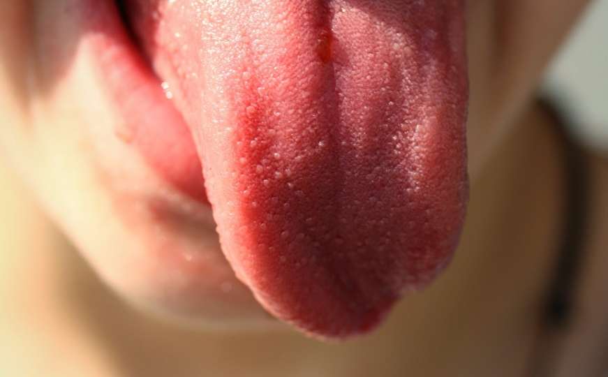 Zašto je bitno da svakog dana očistite jezik?