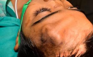 Novi nos uzgojen na dječakovom čelu