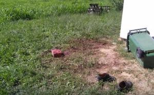 Užas: Dva pit bula do smrti izujedala čovjeka