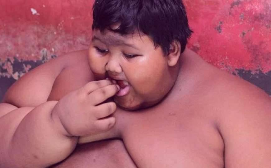 Hospitaliziran desetogodišnji dječak težak 192 kilograma 