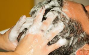 Pomoću aspirina riješite se peruti