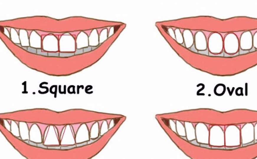 Šta oblik vaših zuba otkriva o vama