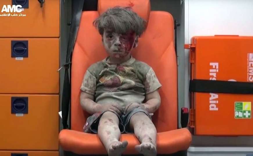 Šta se dalje dogodilo ranjenom dječaku iz Alepa