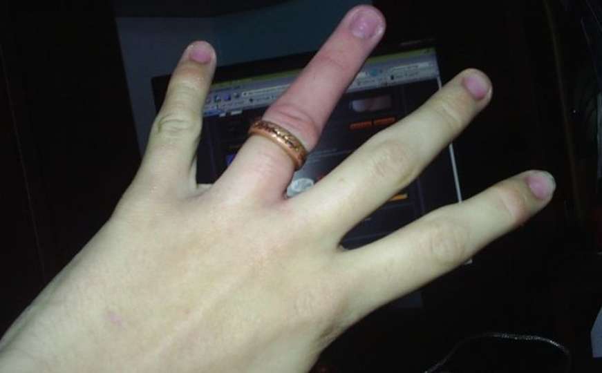 Doktor joj je htio rezati prst, zlatar prsten, a onda je došao inženjer