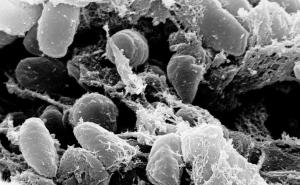 Prijeti nam epidemija jedne od najsmrtonosnijih bolesti 