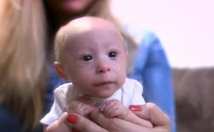 Dirljivo: On je veliki borac, ima sedam mjeseci i samo 1,6 kg