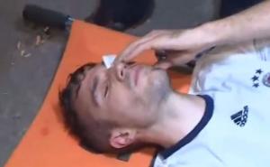 Teška povreda Robina van Persieja, ugrožen mu vid na lijevom oku